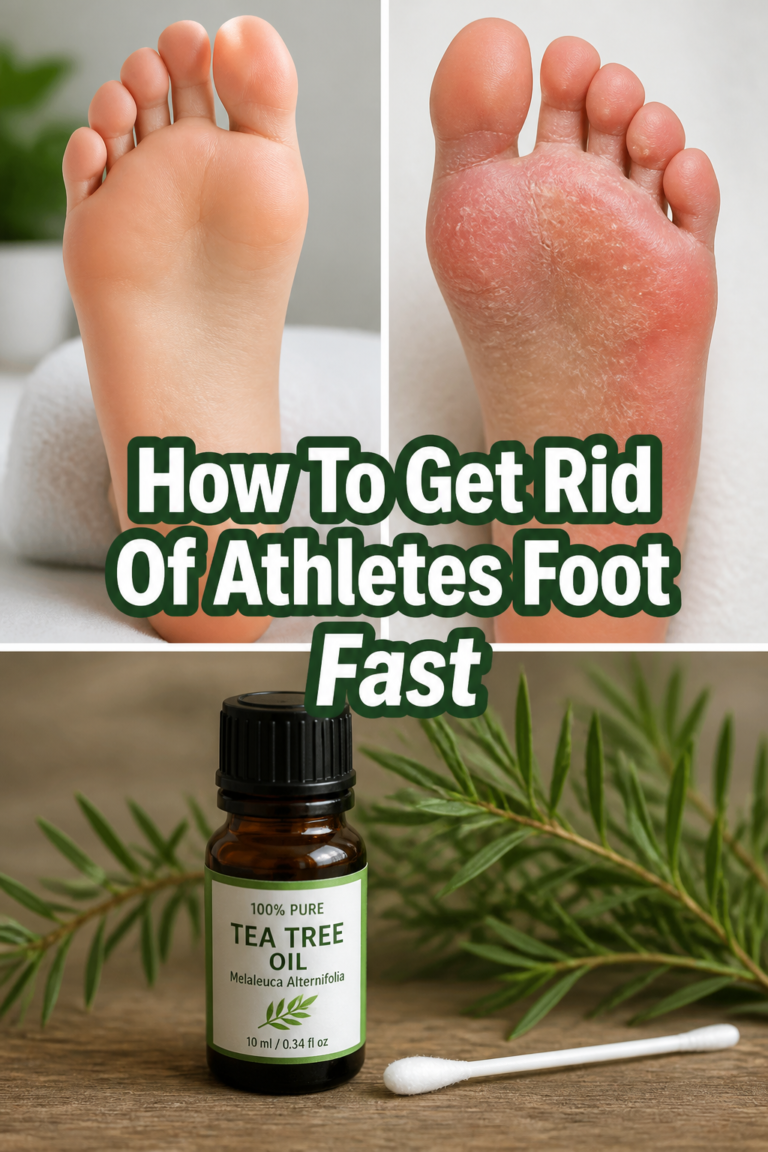🦶 How To Get Rid Of Athletes Foot Fast
