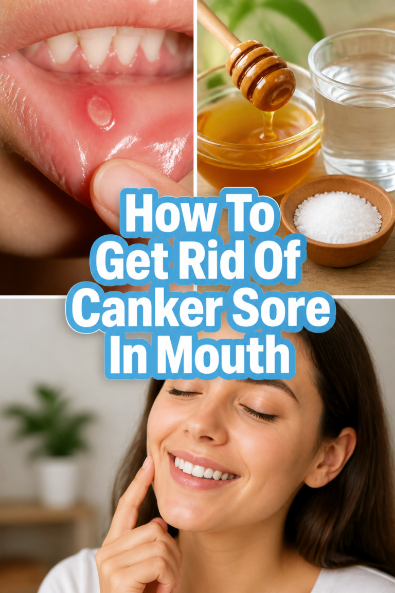 ✨ How To Get Rid Of Canker Sore In Mouth
