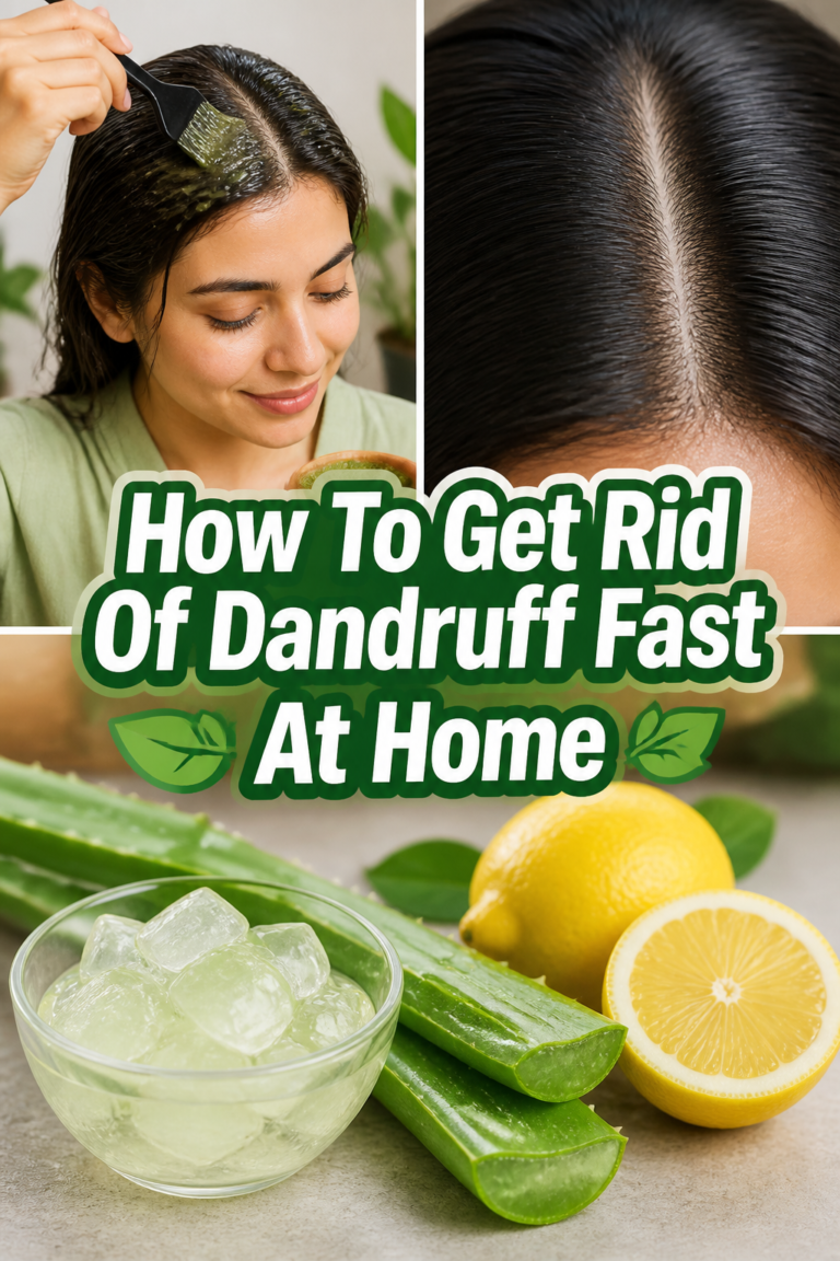 🌿 How To Get Rid Of Dandruff Fast At Home