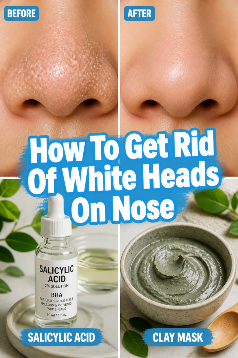 👃 How To Get Rid Of White Heads On Nose