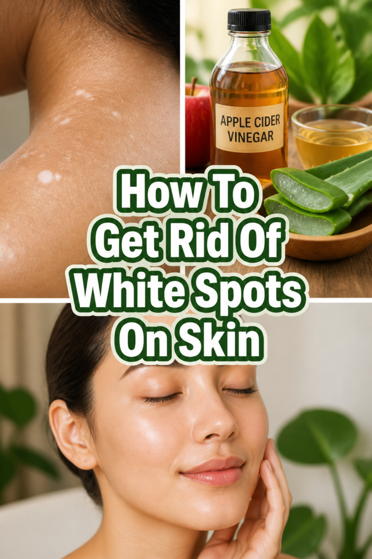 ✨ How To Get Rid Of White Spots On Skin